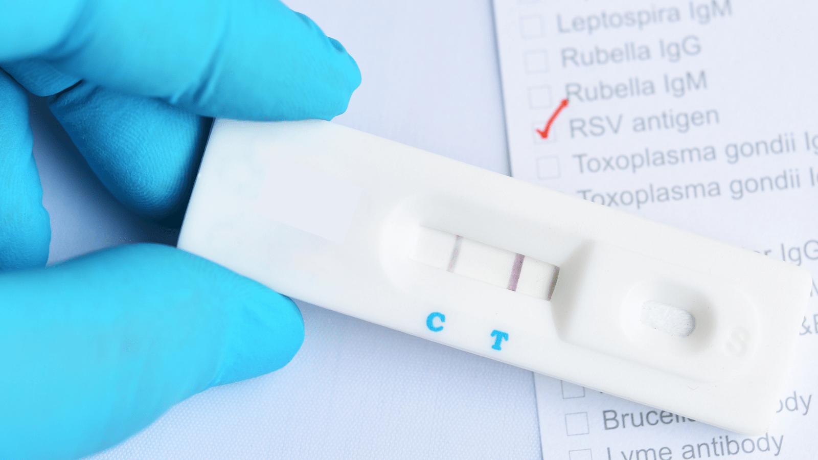 dépistage covid salariés